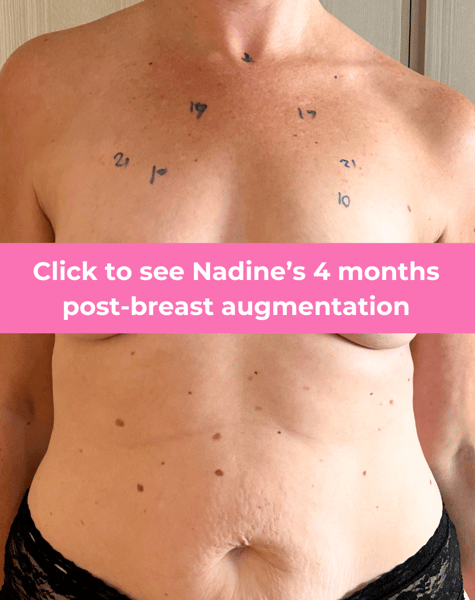 click to see nadine-1