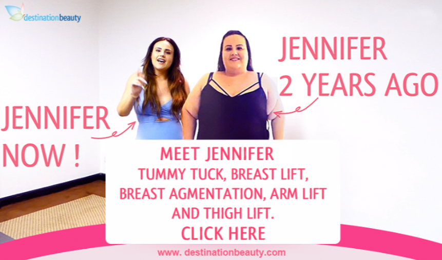 jennifer after massive weight loss-1