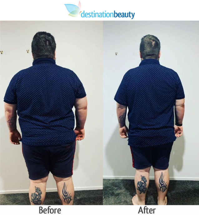 jesse lost 45 kgs in 4 months-2