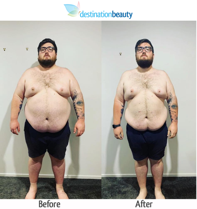 jesse lost 45 kgs in 4 months-3
