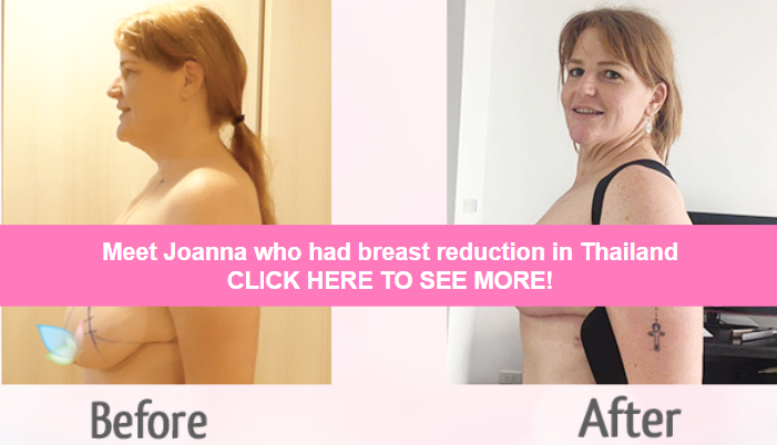 joanna breast reduction thailand
