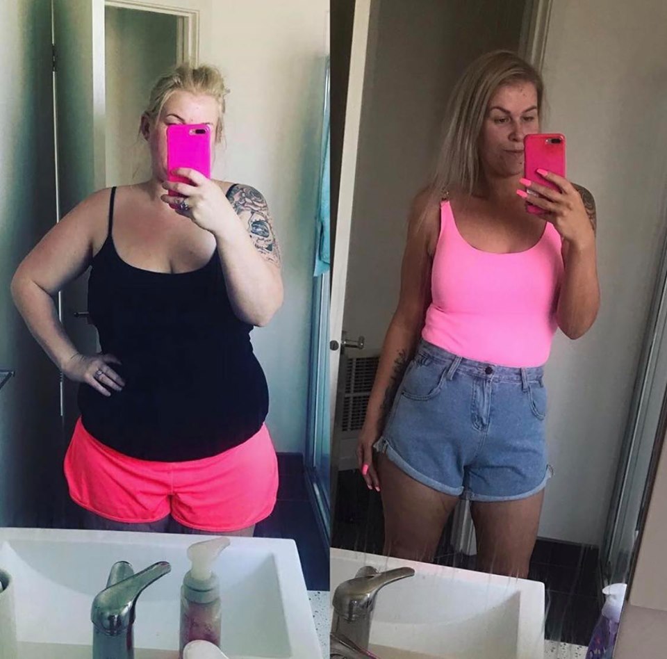 katie weight loss surgery