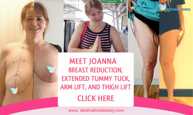 Breasts after Weight Loss - Anca Breahna Plastic Surgeon
