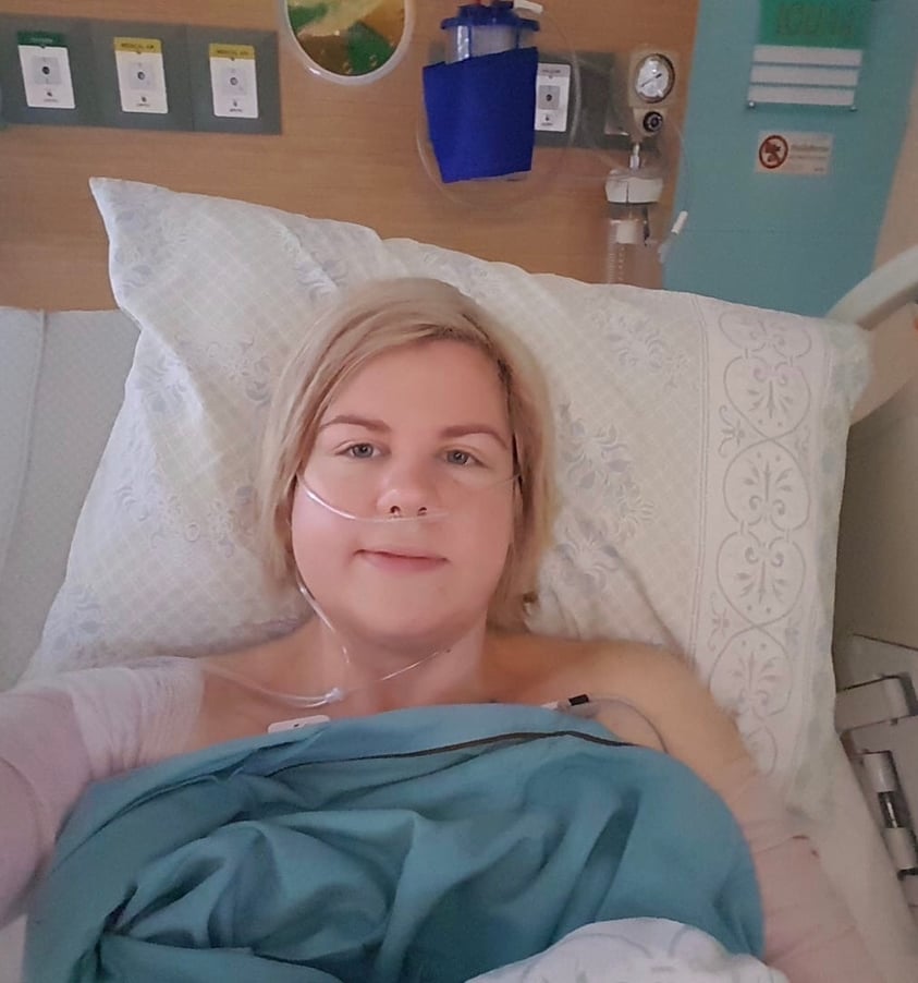 recoverd after breast augmentation with lift, arm lift, and back lift in bangkok