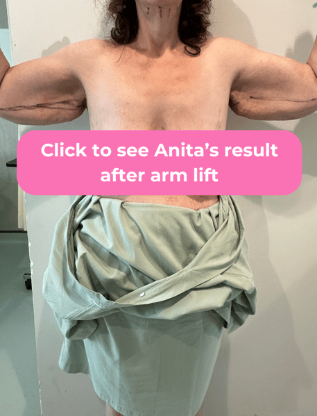 see Anita