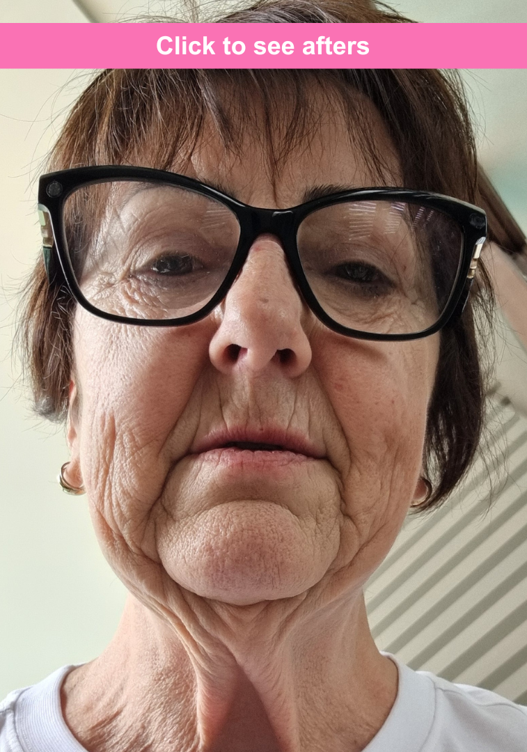 see Debra