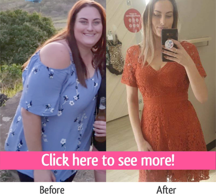 sherilyn before and after gastric sleeve